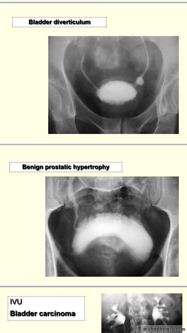 urology slides