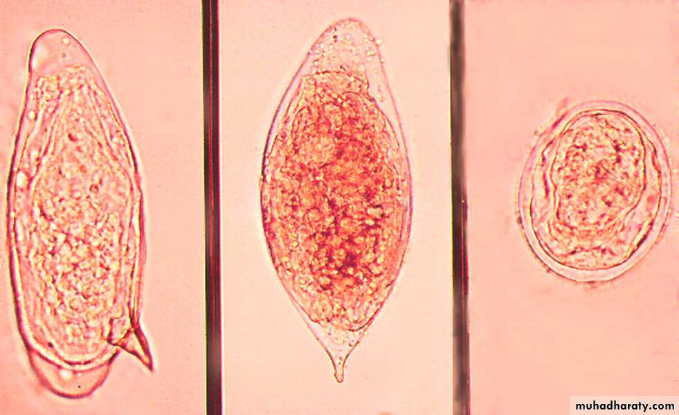 Genitourinary tuberculosis