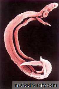 Genitourinary tuberculosis