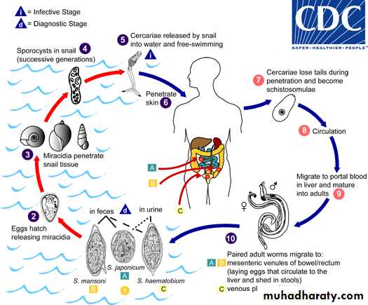 Genitourinary tuberculosis