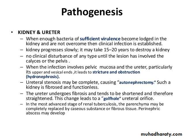 Genitourinary tuberculosis