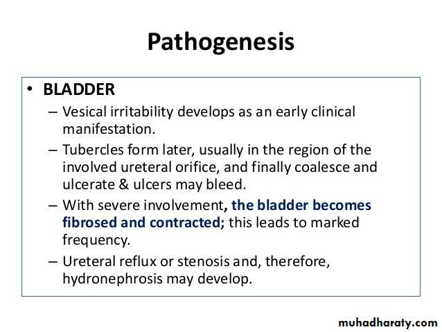 Genitourinary tuberculosis