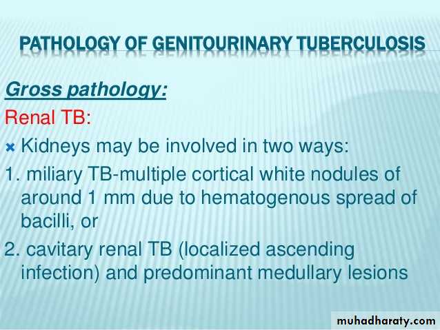Genitourinary tuberculosis