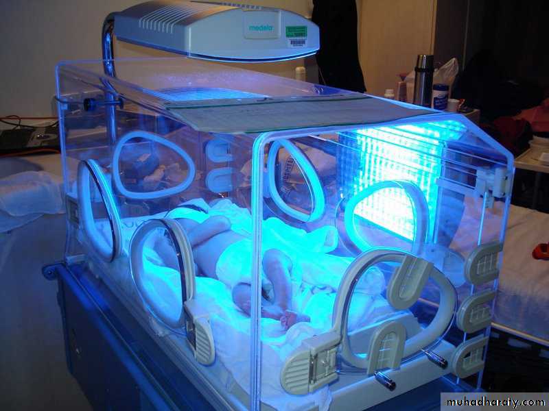 NEONATAL JAUNDICE