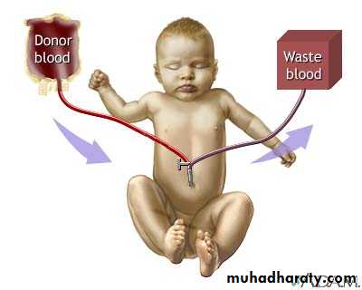 NEONATAL JAUNDICE