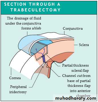 Ophthalmology Lecture Notes