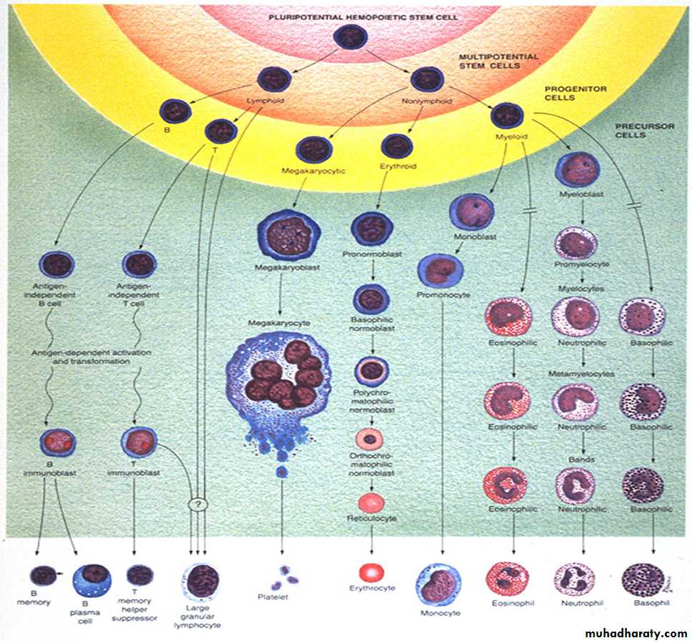 Aplastic anemia