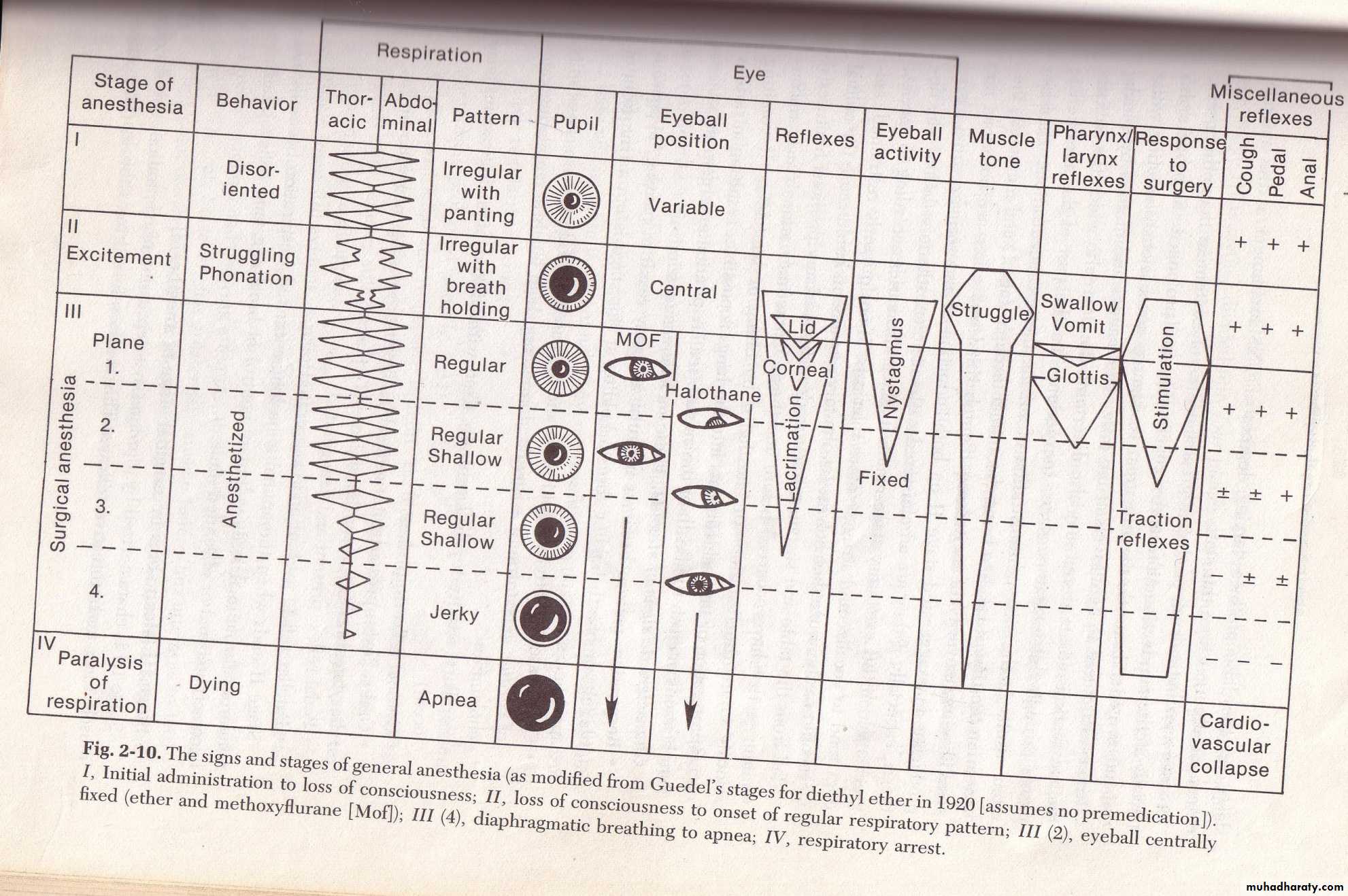 Stages of Anesthesia
