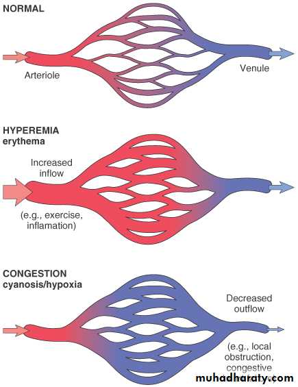 Hemodynamic Disorders