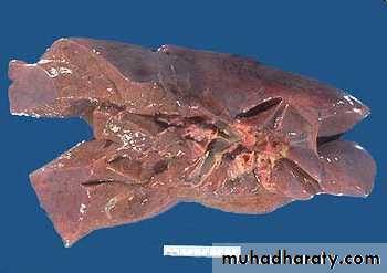 Hemodynamic Disorders