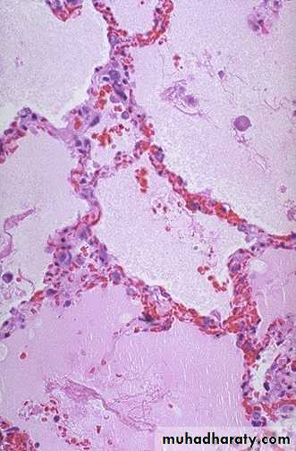 Hemodynamic Disorders