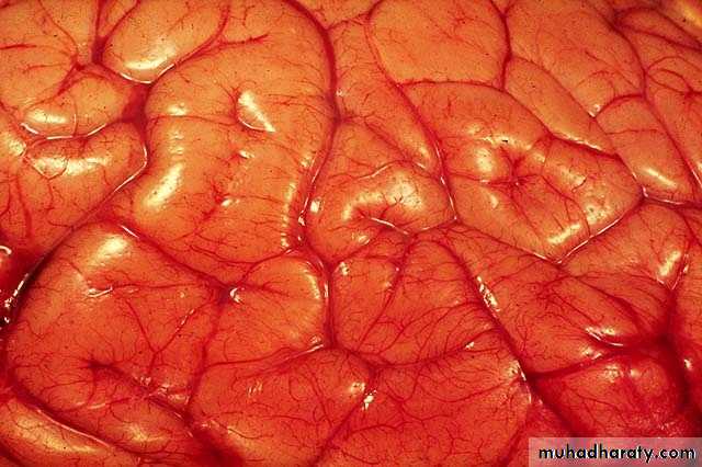 Hemodynamic Disorders