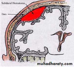 Hemodynamic Disorders