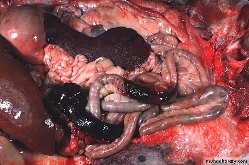 Hemodynamic Disorders