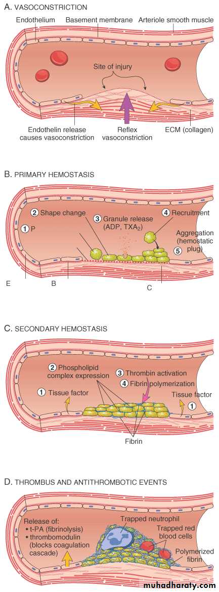 Hemodynamic Disorders