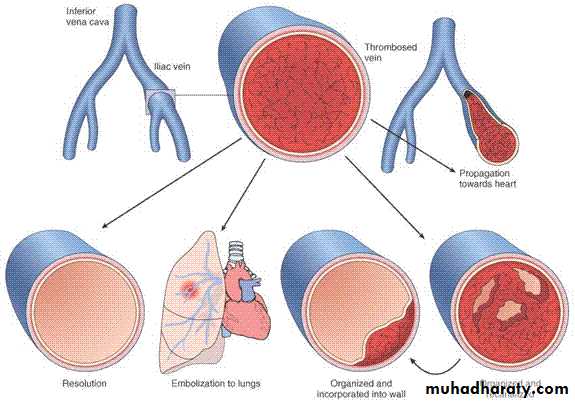 Hemodynamic Disorders