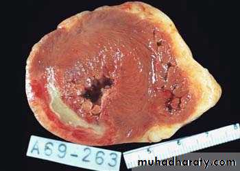 Hemodynamic Disorders