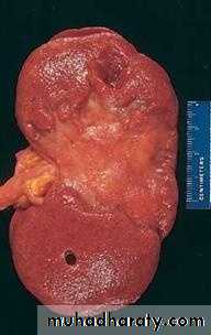Hemodynamic Disorders