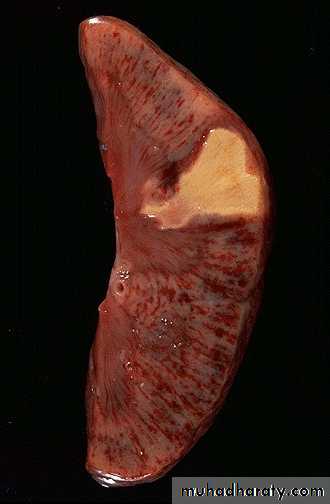 Hemodynamic Disorders