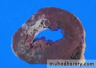 Hemodynamic Disorders