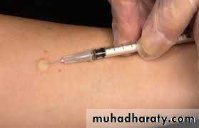 Local Anesthesia