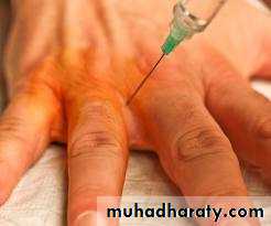 Local Anesthesia
