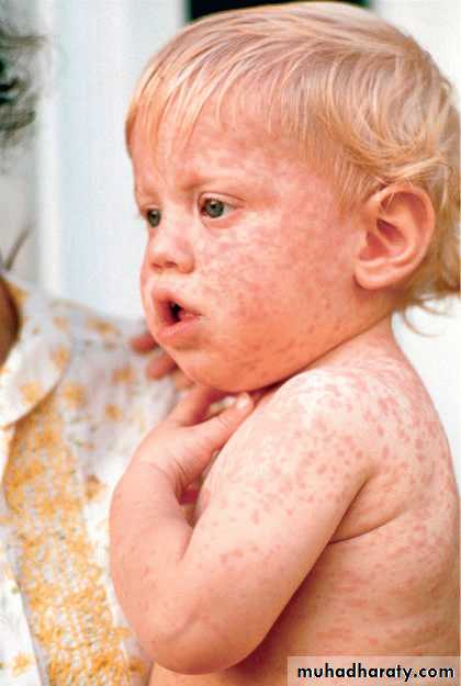 Infectious Disease
