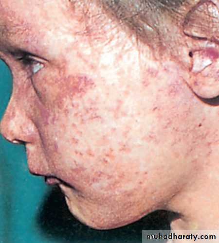 Infectious Disease