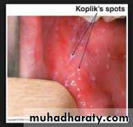 Infectious Disease