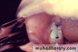 Infectious Disease