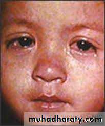 Infectious Disease