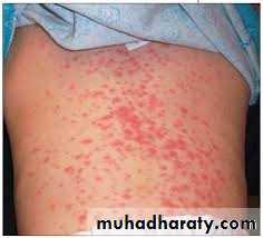 Infectious Disease