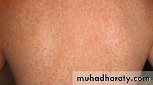 Infectious Disease