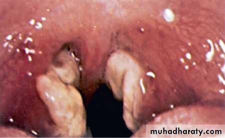 Infectious Disease