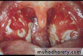 Infectious Disease