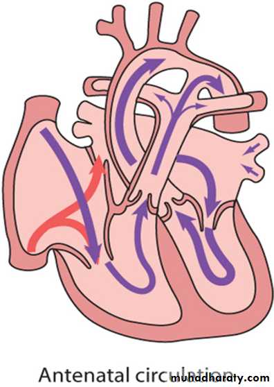 Cardiac Diseases