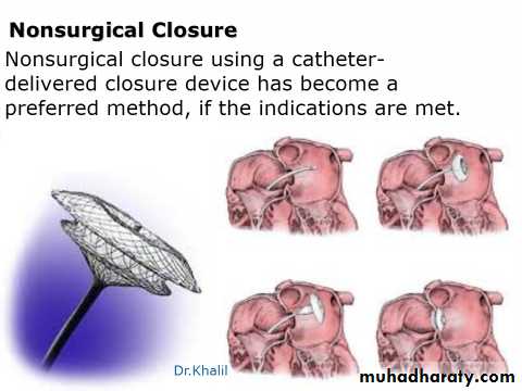 Cardiac Diseases