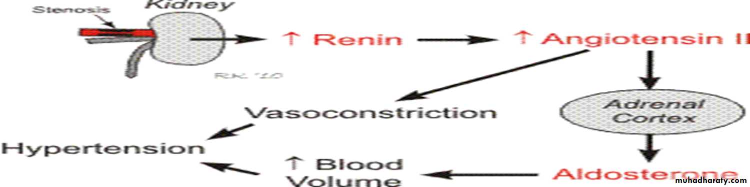 Renal artery stenosis
