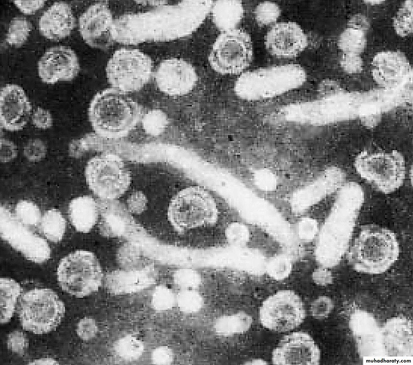 1 Viral Hepatitis