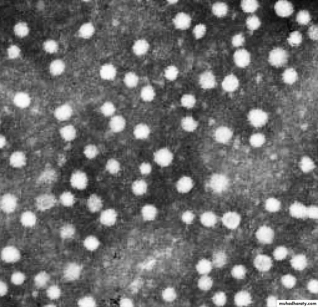 1 Viral Hepatitis