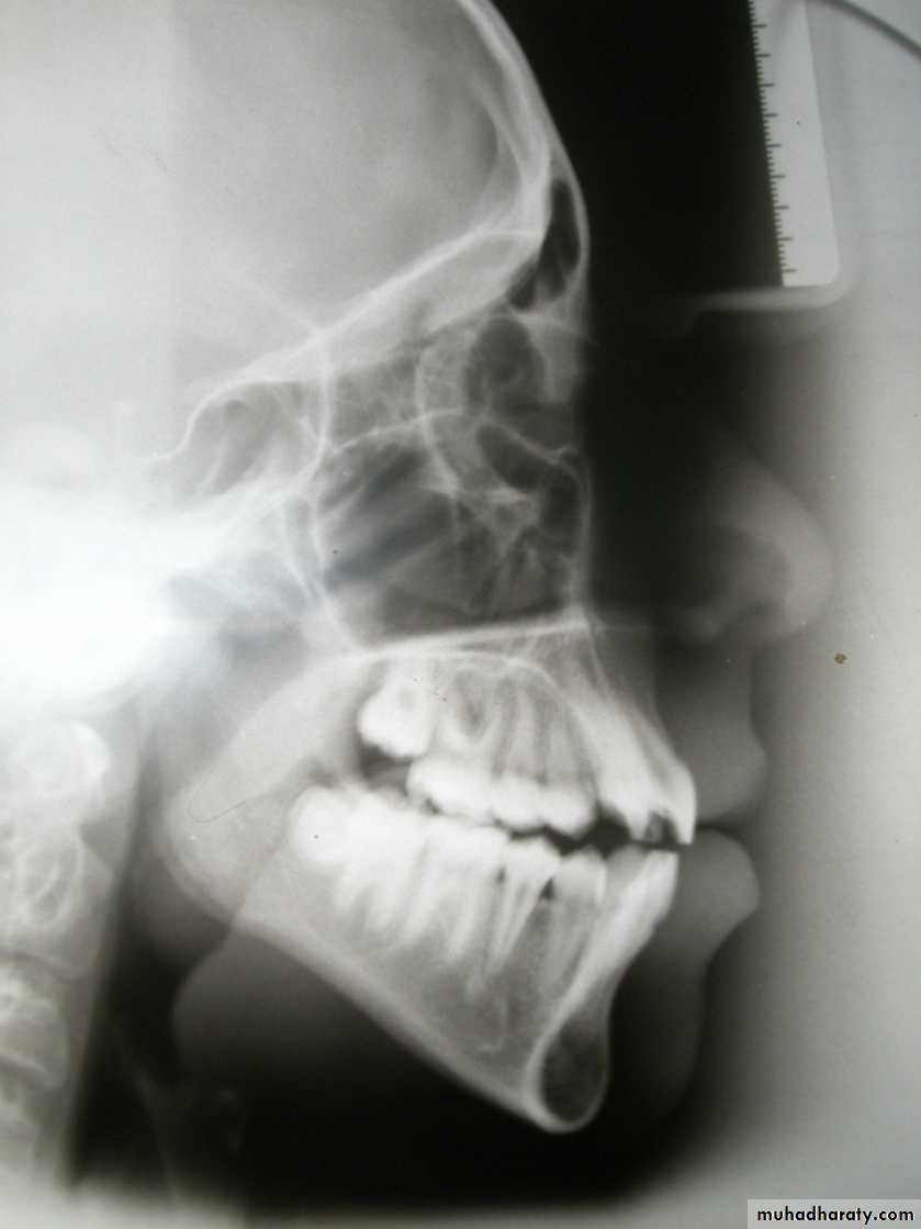 Cephalometric