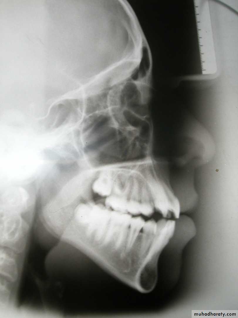 Cephalometric