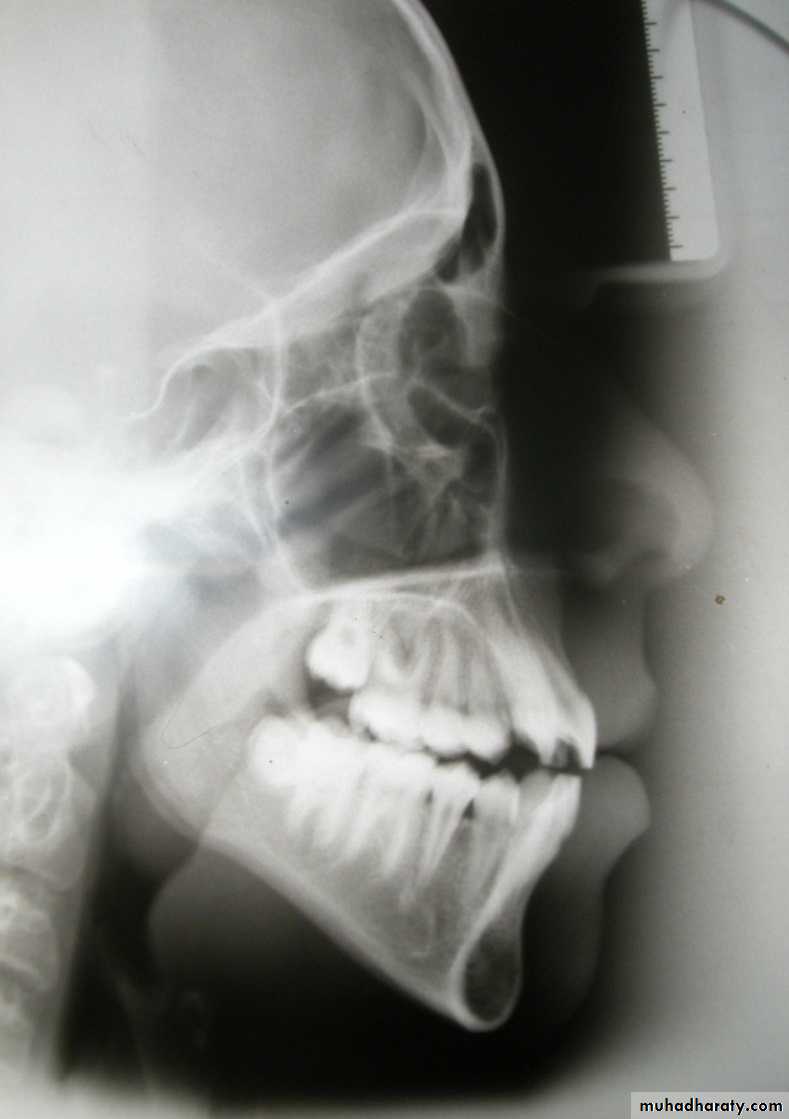 Cephalometric