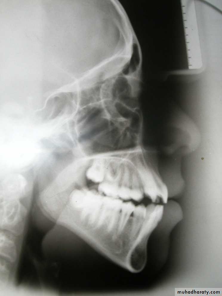 Cephalometric