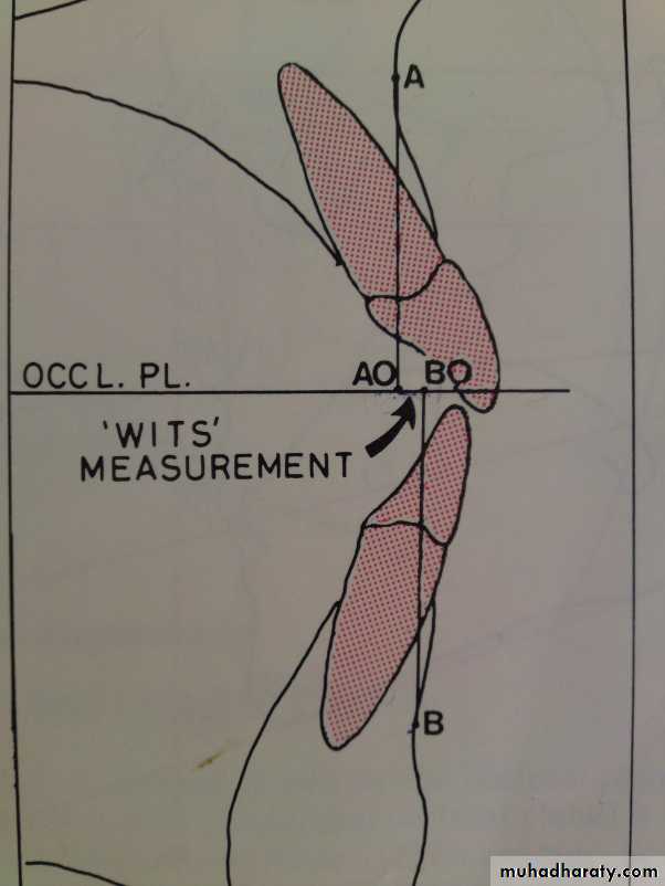 Cephalometric