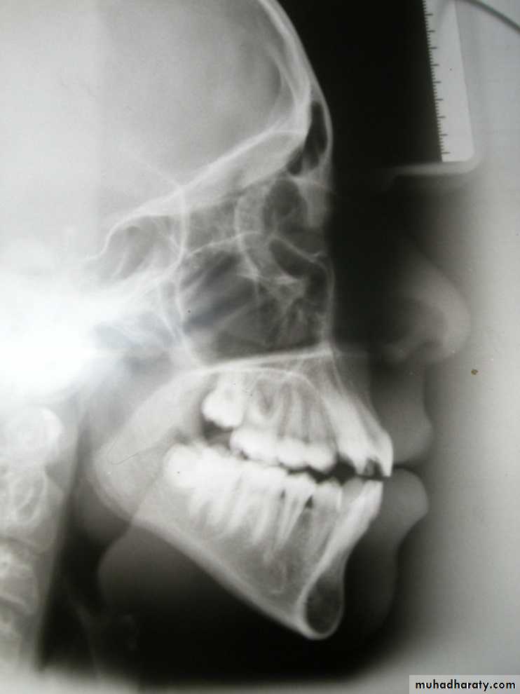 Cephalometric