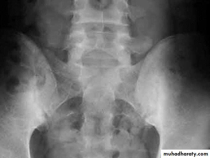 BONE