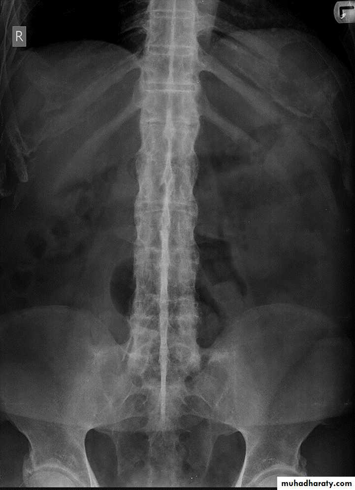 BONE