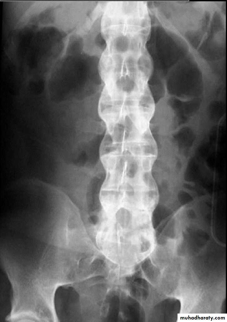 BONE