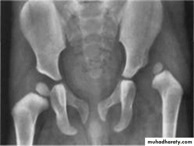 BONE